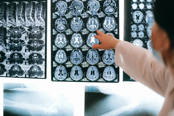 Brain Disease Diagnosis